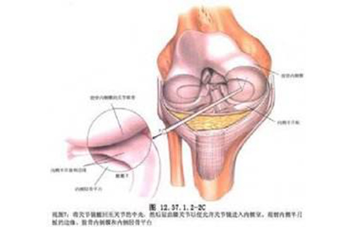 運動醫(yī)學（關(guān)節(jié)鏡）?？? title=